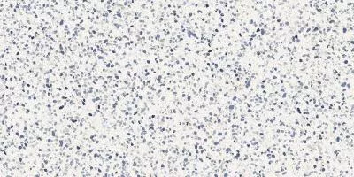 Плитка Marazzi FRAMMENTO MACRO AZZURRO R10 RT 60x120, Фото